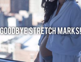 GOODBYE STRETCH MARKS: Marcelle for Thyme